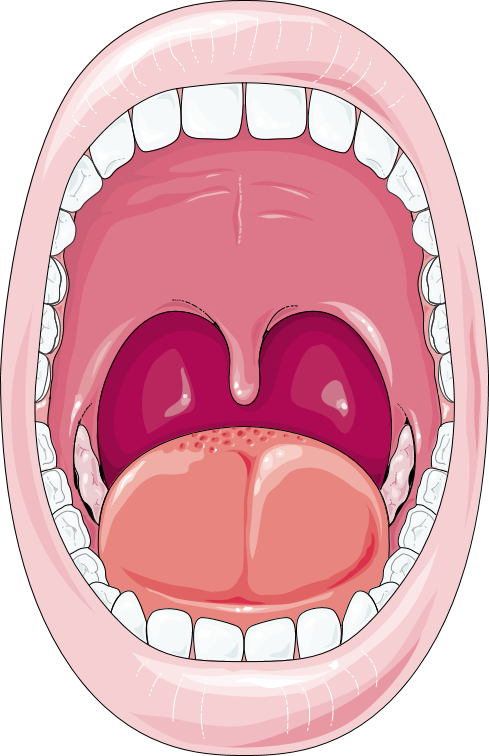 Front view of an open mouth showing the tongue, teeth, hard palate, soft palate, uvula, and palatine arches — all the structures involved when mouth breathing becomes a habit. — Servier Medical Art, CC BY 4.0