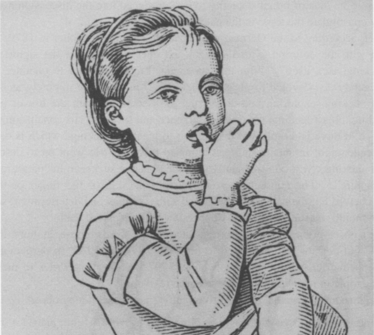 A 19th-century woodcut of a child with thumb in mouth — the historical pediatric literature on thumb-sucking that established the clinical understanding of the habit. Pure drawn engraving, public domain. — Lindner S, "Das Saugen an den Fingern, Lippen, etc. bei den Kindern (Ludeln)," Jahrbuch für Kinderheilkunde (Leipzig), 1879–1880.