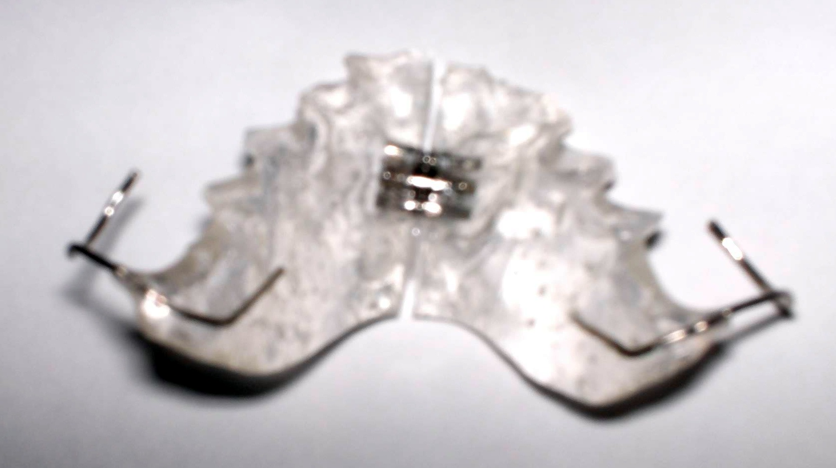 A Haas-type palatal expander — a clear acrylic plate with a central expansion screw — resting on a white surface. This is one of the appliances an adult might wear during maxillary expansion, the orthodontic phase that widens a narrow upper jaw.